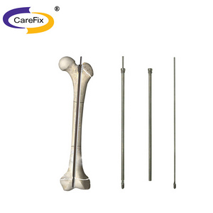 Trauma Implants Stainless Steel Orthopedic Intramedullary Nail