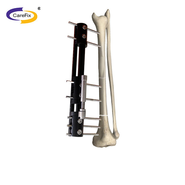 CareFix Orthopedic Tibial Multi-Function External Fixation Surgical Instruments