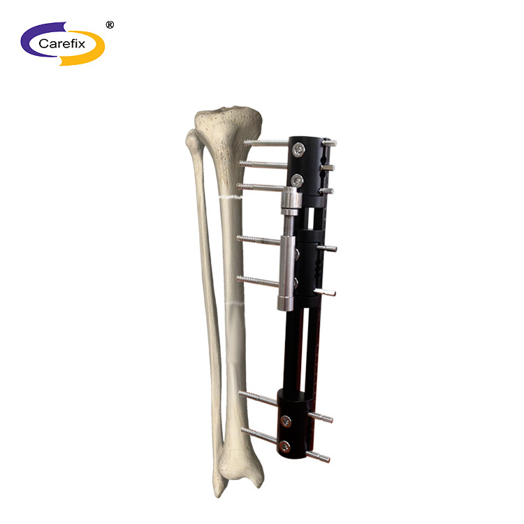 CareFix Orthopedic Tibial Multi-Function External Fixation Surgical Instruments