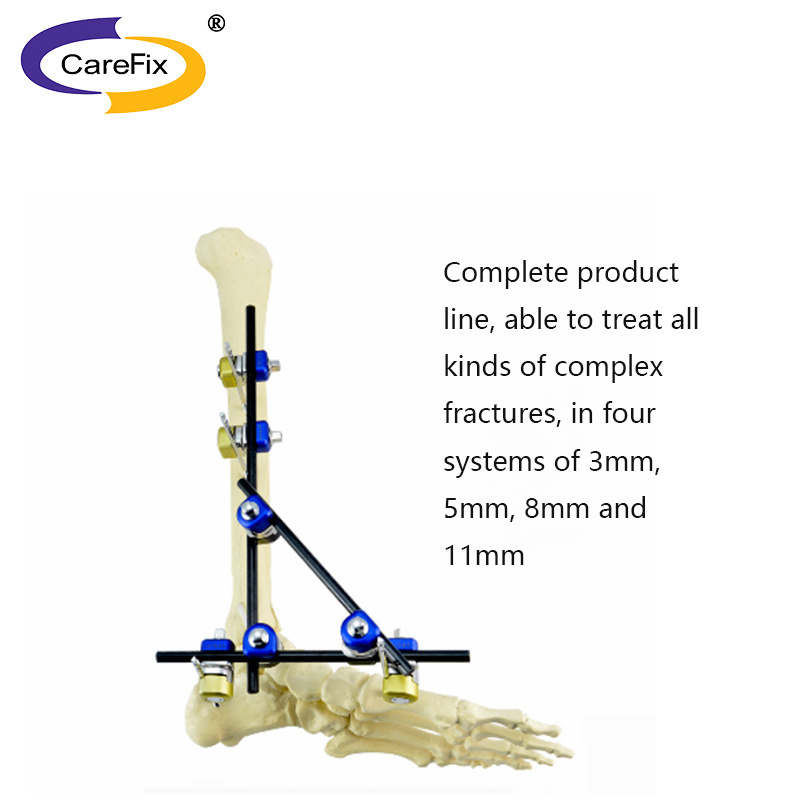 CareFix large trauma orthopedic carbon fiber combined external knee fixation