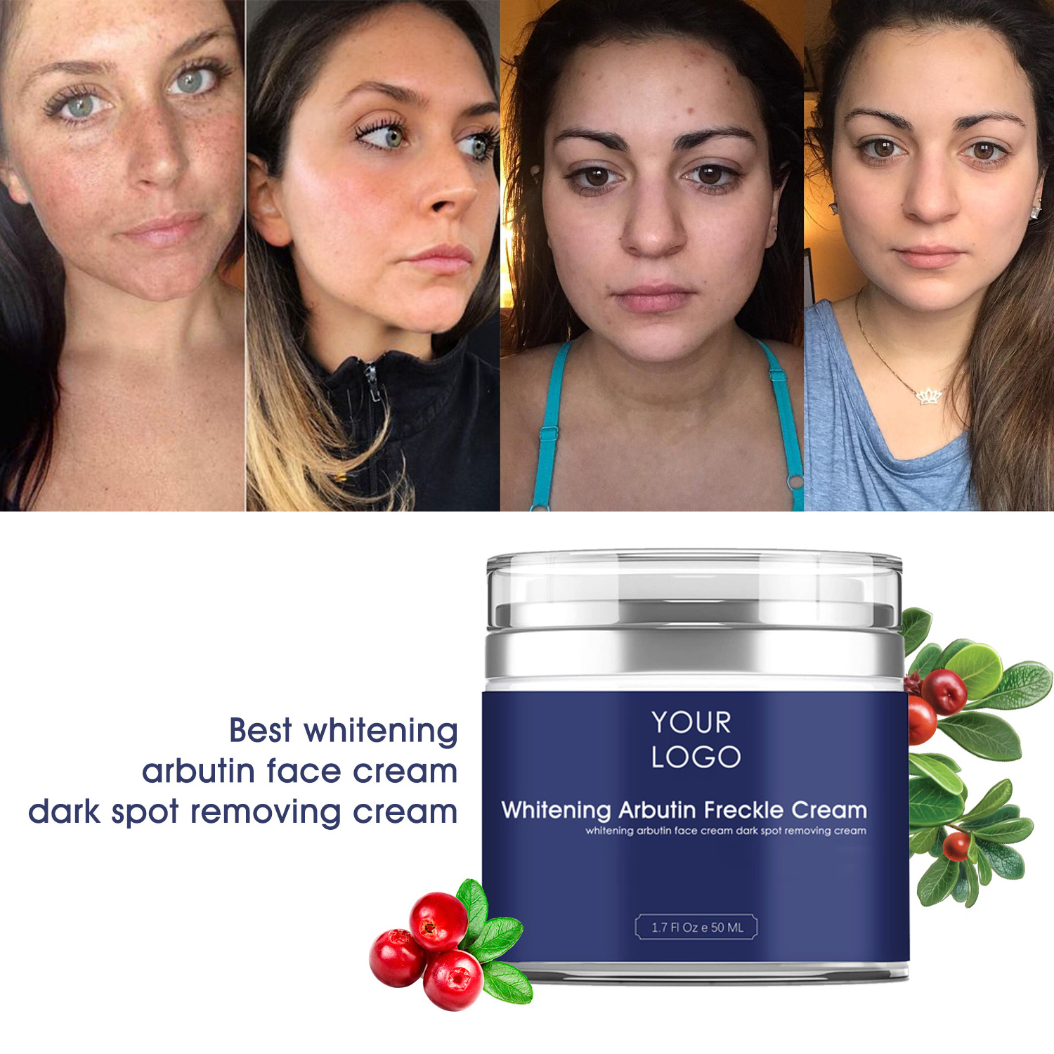 Best whitening arbutin face cream dark spot removing cream