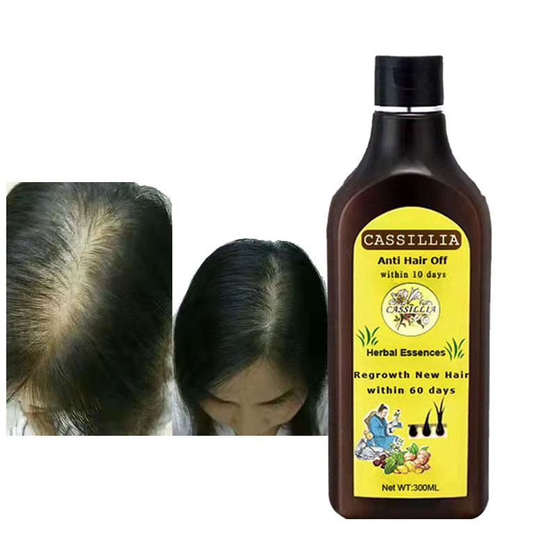 Private Label 100 % Pure natural Organic vegan anti-off loss remove moisturizing hair growth Argan Oil Shampoo And Conditioner