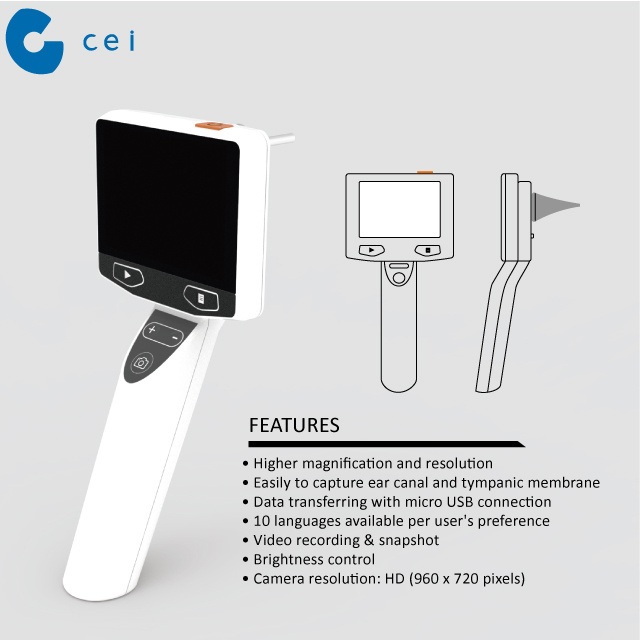 Rechargeable Digital Otoscope Micro Camera Video ENT Set Optical Equipment