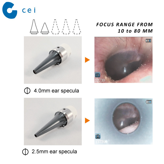 Rechargeable Digital Otoscope Micro Camera Video ENT Set Optical Equipment