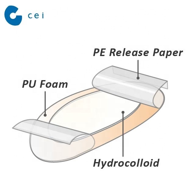 Medical Disposable Products Absorbent Waterproof Hydrocolloid Dressing Wound Pad