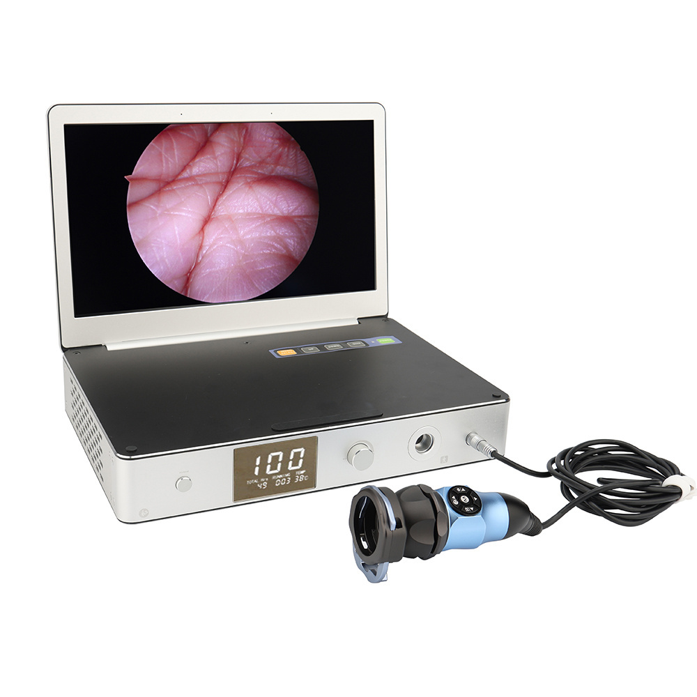 11.6 Inch 3 In 1 Medical Portable Endoscope Camera for Endoscopy USB HDMI HD 1080P Endoscope Camera System portable all in one