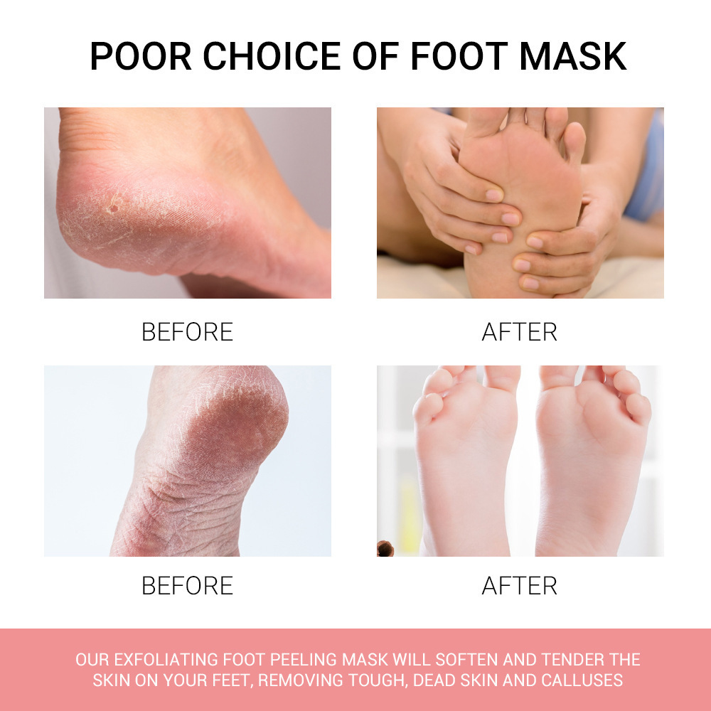 Peach Foot Mask Dead Skin Removing and Moisturizing Foot Mask Exfoliating and Softening Foot Care Set