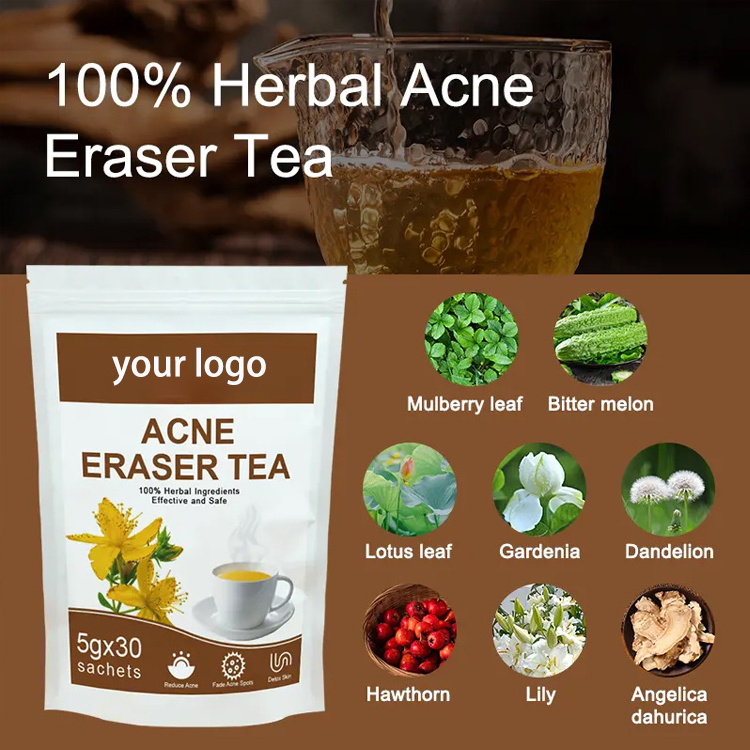 Custom Tea Natural Ingredients Herbal Health Skin Beauty Tea Acne Tea