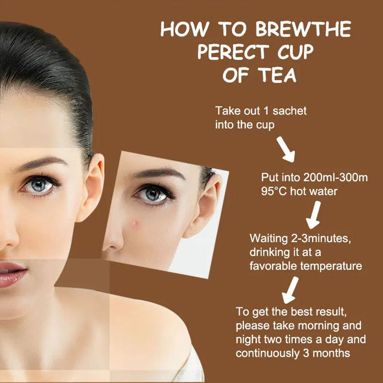 Custom Tea Natural Ingredients Herbal Health Skin Beauty Tea Acne Tea