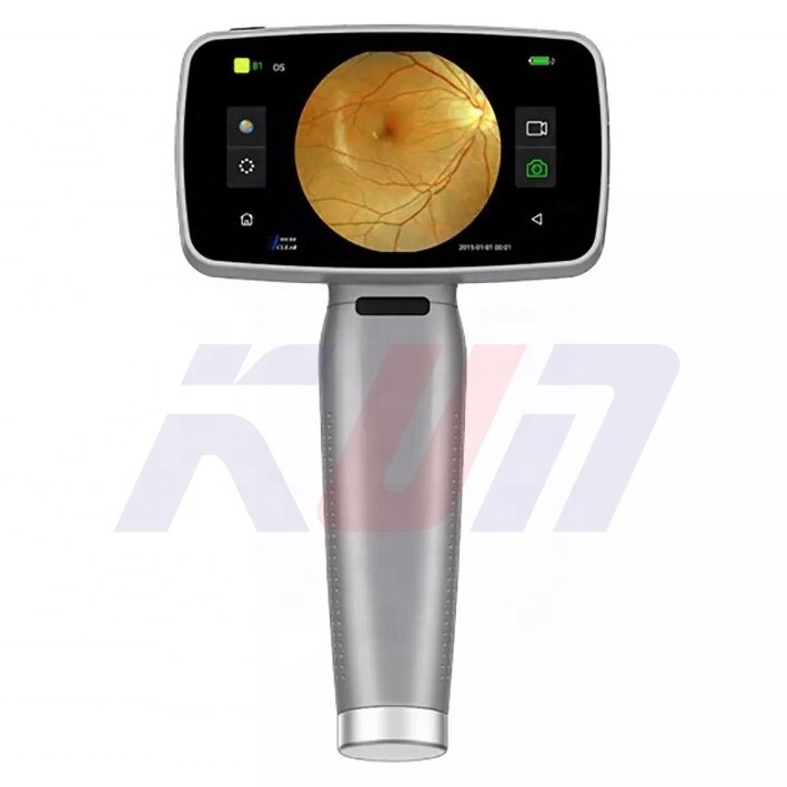 Export standard China handheld non mydriatic fundus camera