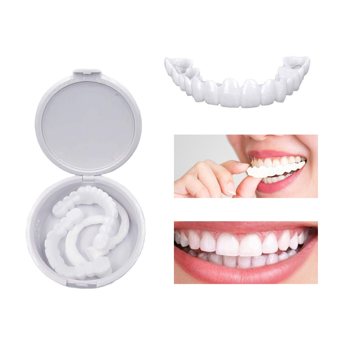 High Quality Guaranteed Veneers Dental Teeth Smile Denture Teeth Dental Teeth Cosmetic Veneer