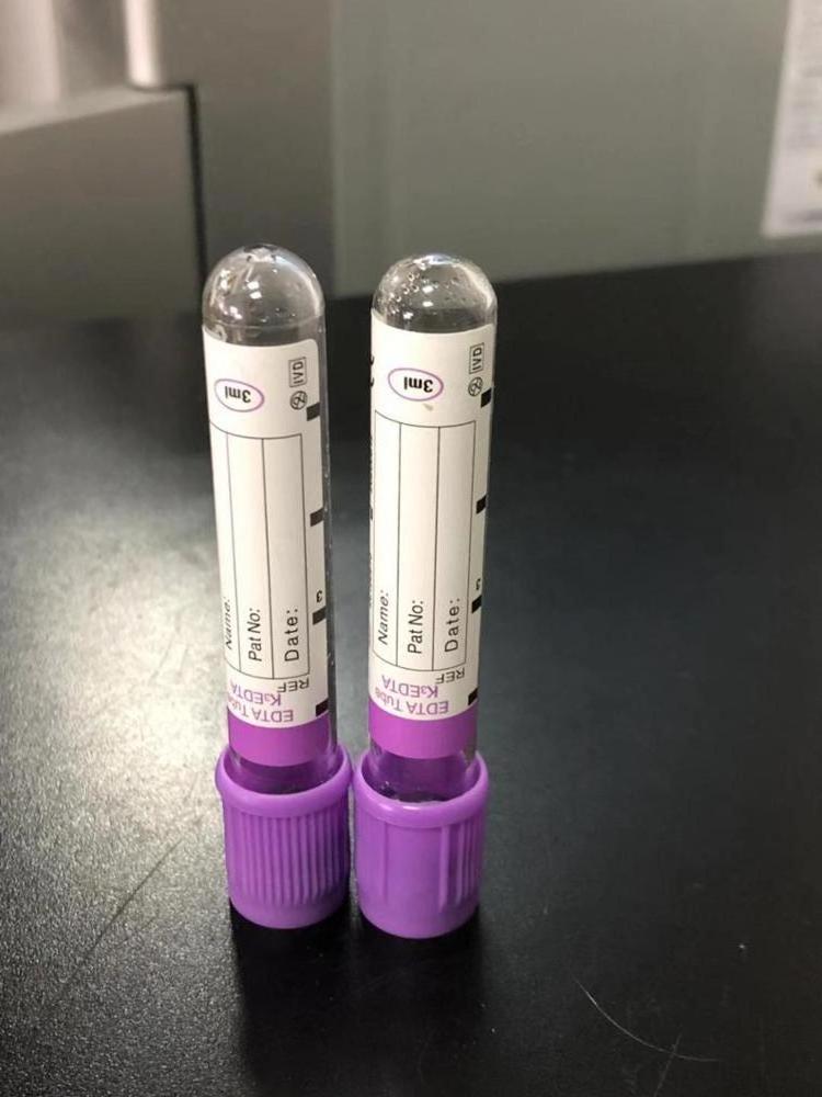 good price purple hat lab 2ml 4ml 5ml 10ml anticoagulant glass pet vacuum edta k2 k3 blood test collection tubes