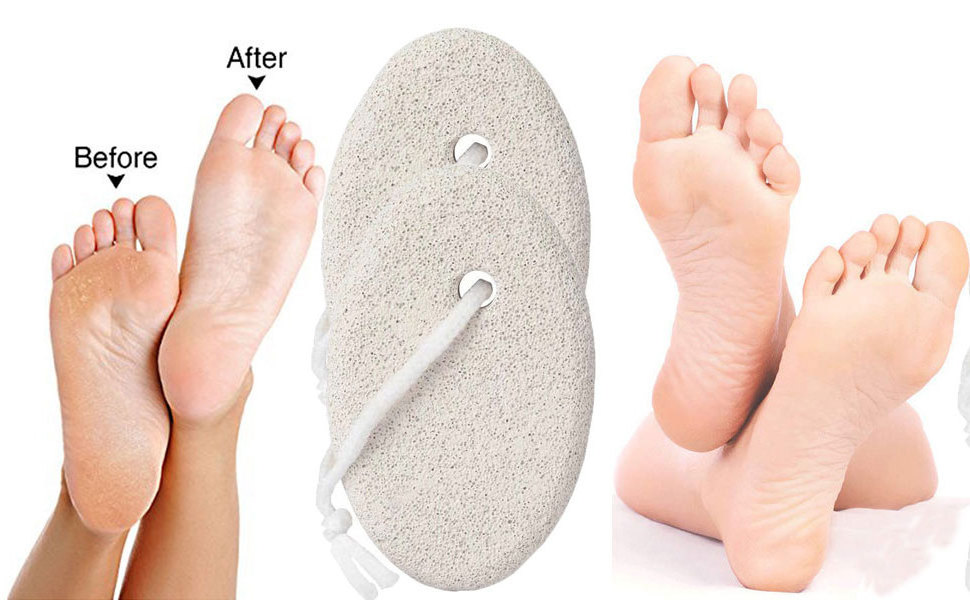 Pumice Stone for Feet Foot File Exfoliation to Remove Dead Skin