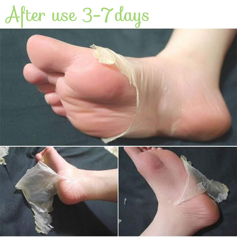 Privatr Label Custom Printed Korea Natural Collage Exfoliating Moisturizing Foot Peel Mask Peeling Socks Feet Skin Care