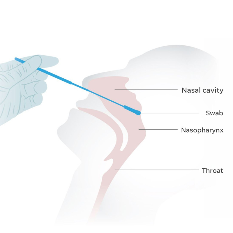 Medical Sterile Amies Transport Medium Break Nasopharyngeal Sampling Nasal Test Rna Swab