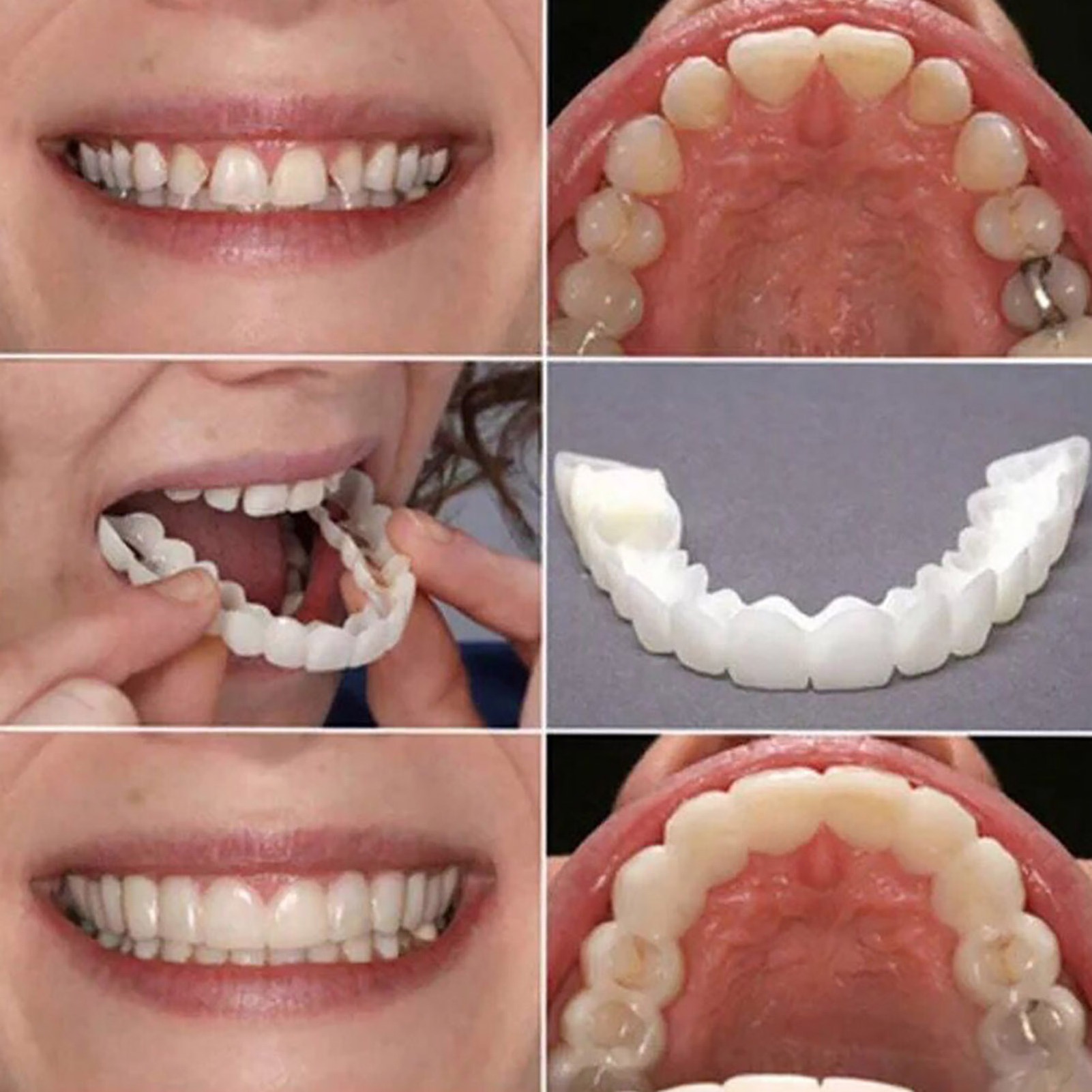 Beauti Snap On Denture Silicone Cover Plastic Whiten Dental teeth upper lower false teeth cover snap on teeth veneers dental