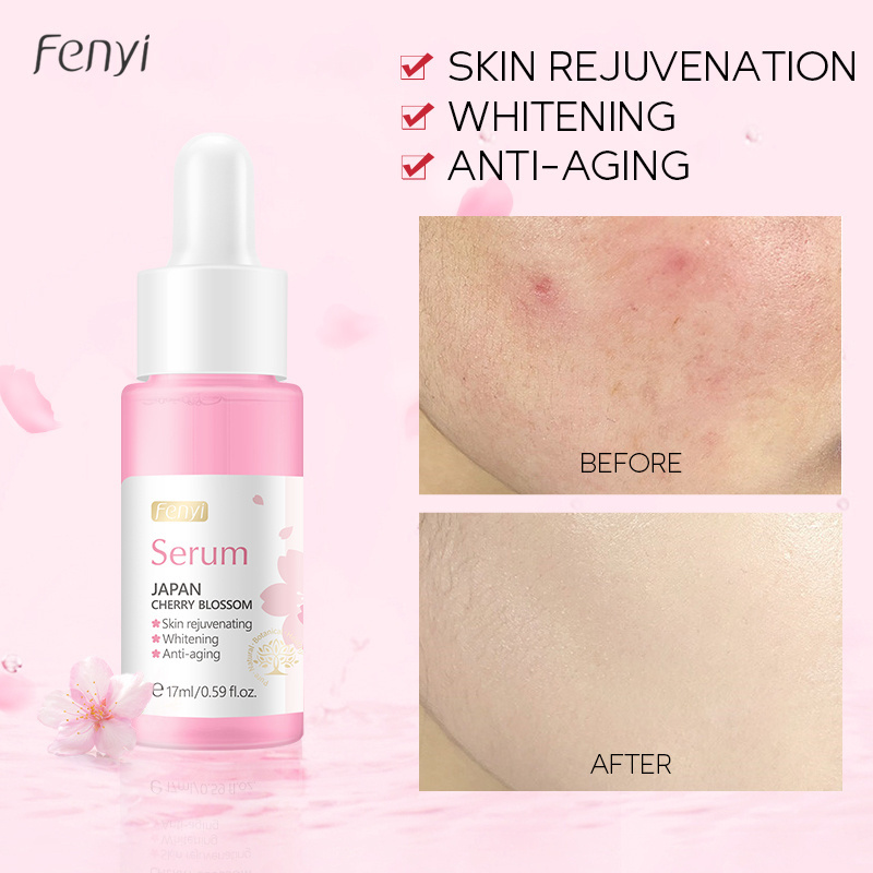 Fenyi Japan Cherry Blossom Face Serum 17ml Brighten Skin Tone Anti-Aging Moisturizing Facial Serum