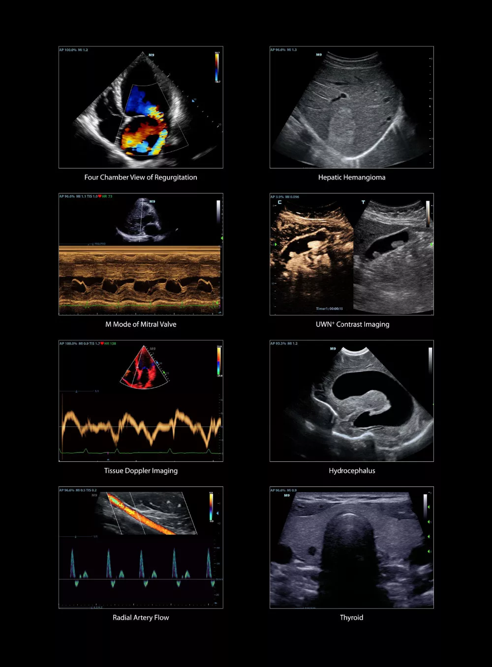 mindray m9 echocardiography color doppler machine  ecografo mindray m5 m7 m9 ecografos mindray] best price