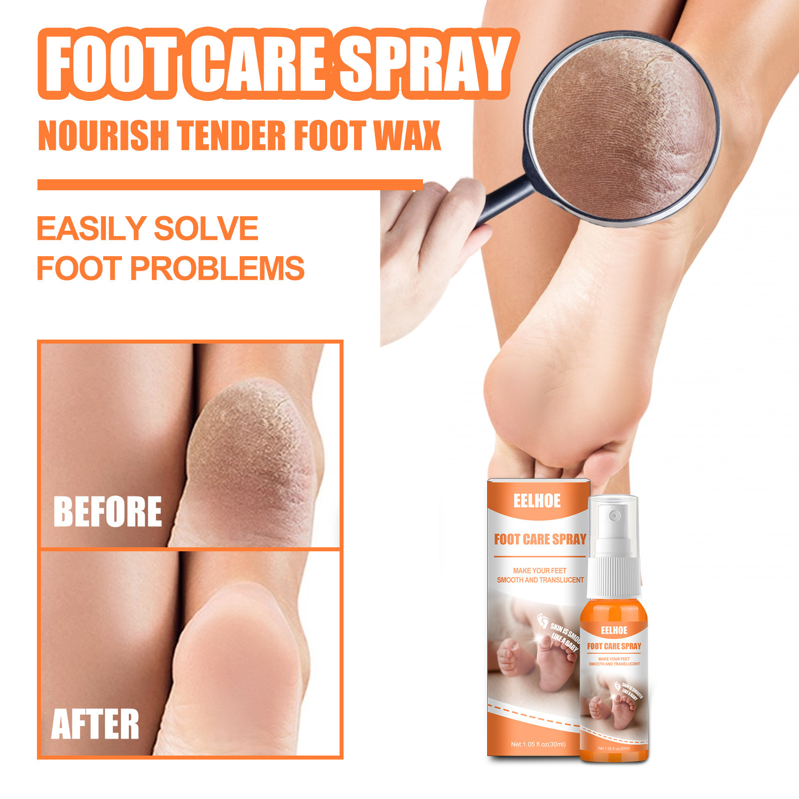 eelhoe Foot Care Spray heel elbow knee exfoliating spray foot exfoliating calluses wholesale