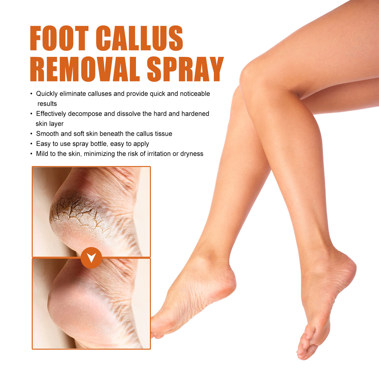 OUHOE Foot exfoliating spray Repair heel calluses dead skin anti-chapping moisturizing foot care spray