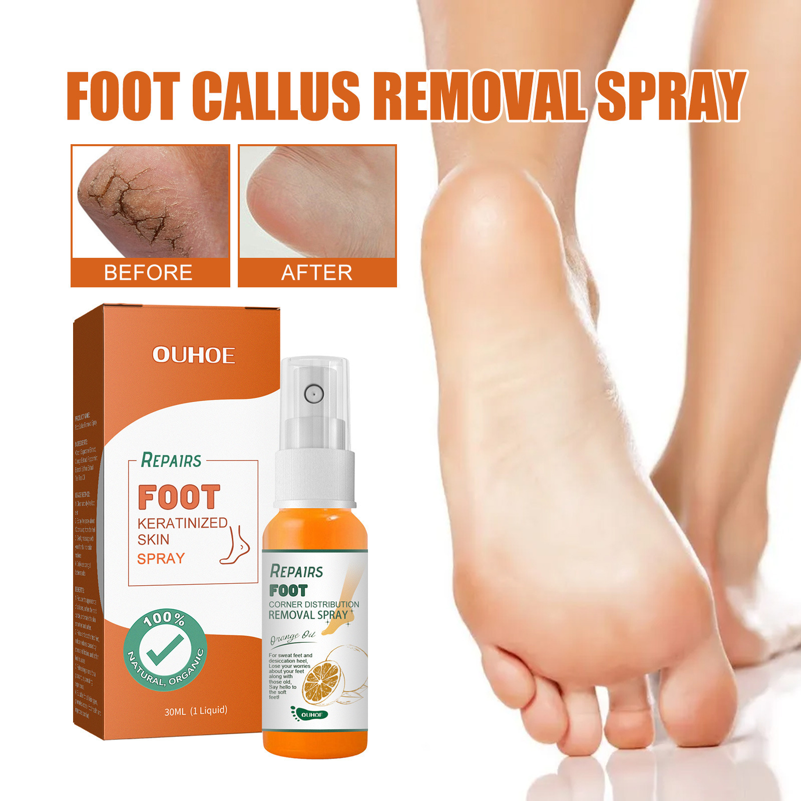 OUHOE Foot exfoliating spray Repair heel calluses dead skin anti-chapping moisturizing foot care spray