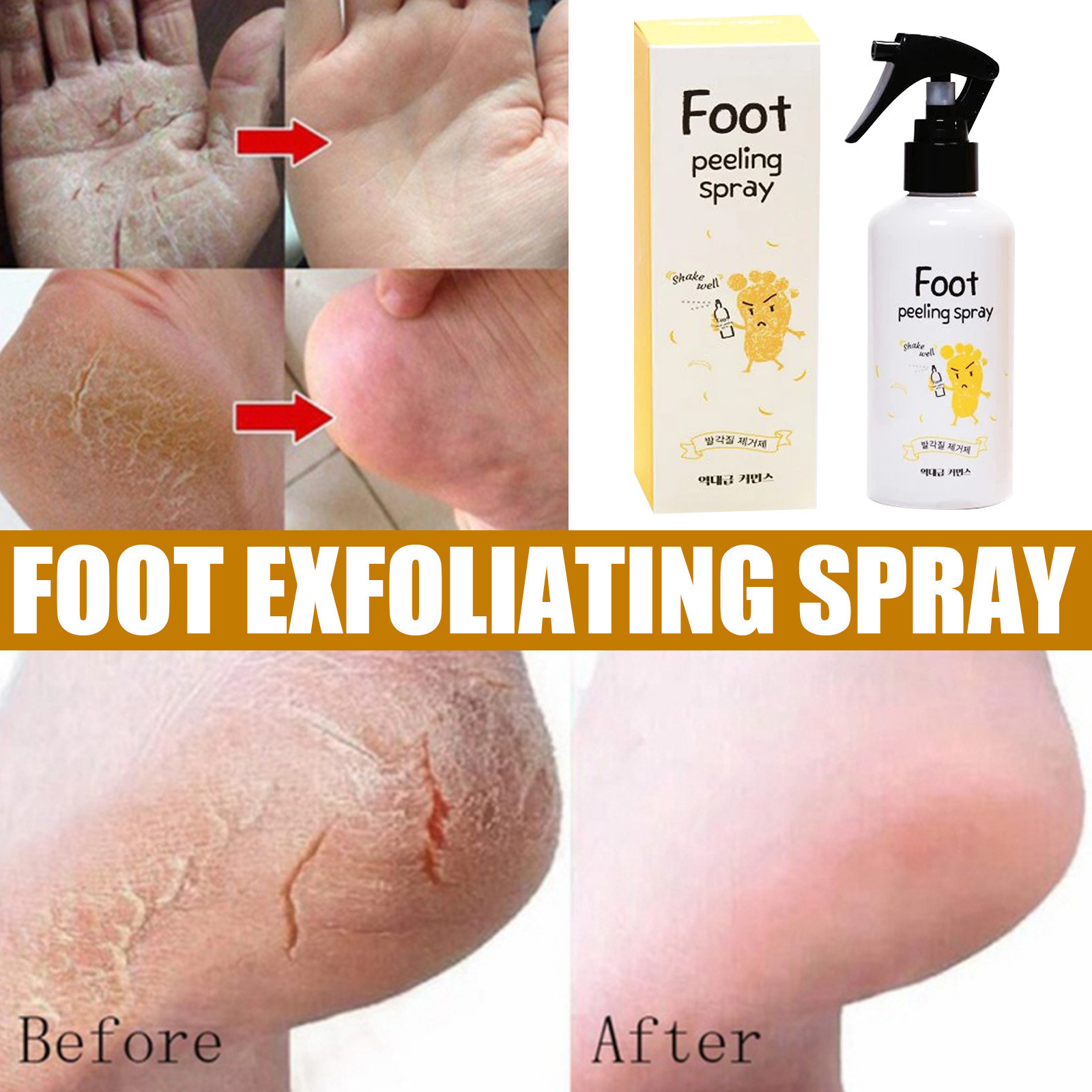 South Moon Foot Patch Brightening and Whitening Spray for Exfoliating and Repairing Calluses CN Plug Type Care Solution