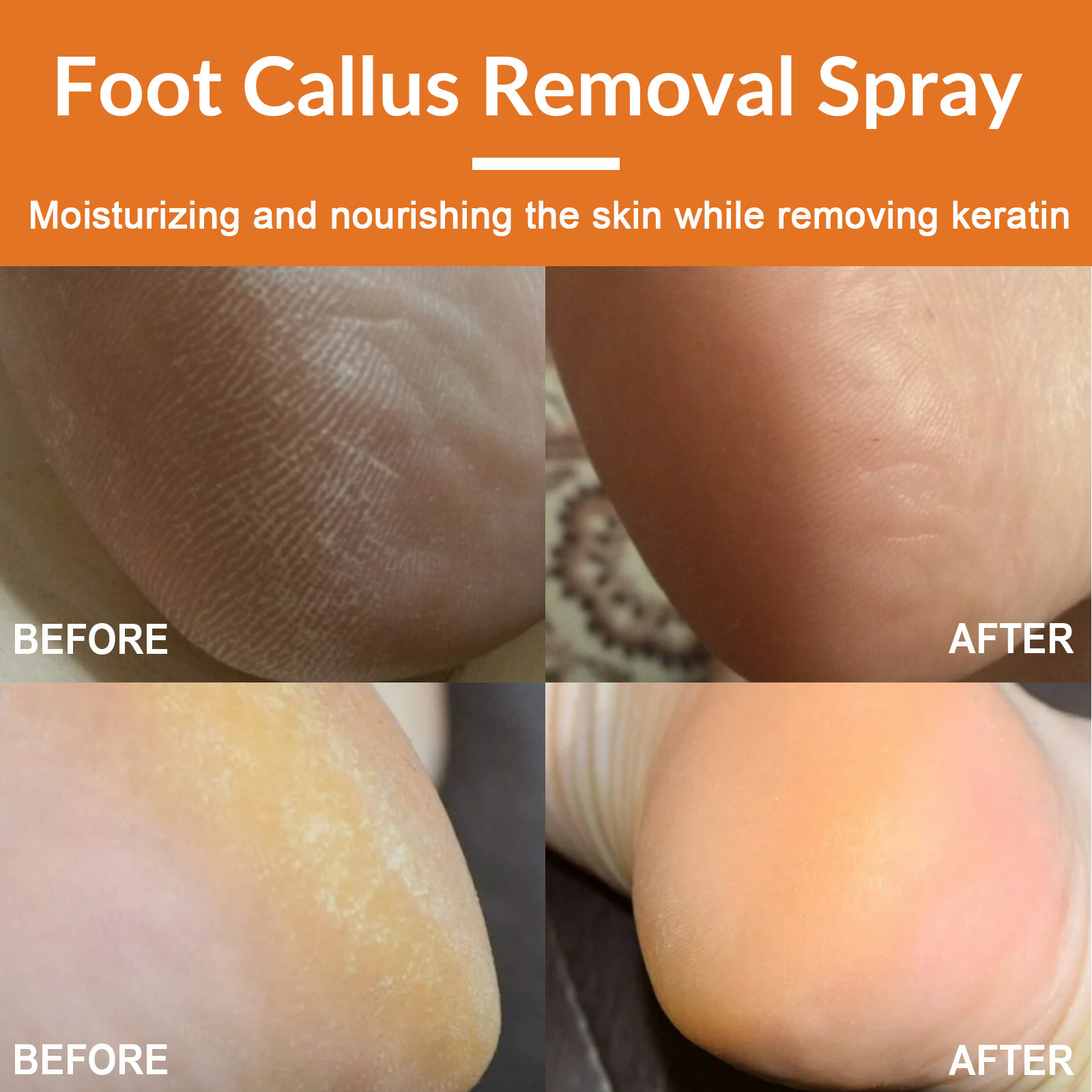 South Moon Foot exfoliating spray Mild callose remove dead skin cleaning repair rough calluses removing