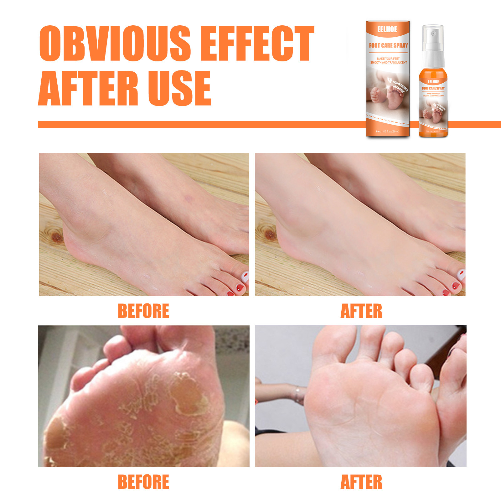 eelhoe Foot Care Spray heel elbow knee exfoliating spray foot exfoliating calluses wholesale