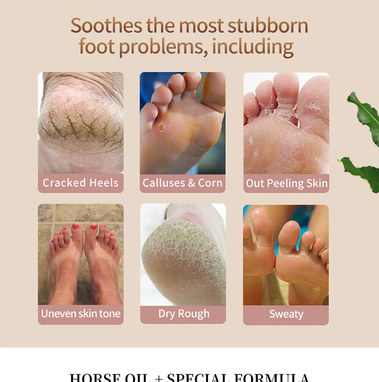 Horse Oil Foot Care Cream For Cracked Heels Exfoliating Anti Crack Peeling Dead Skin Removal Foot Repair Foot Cream