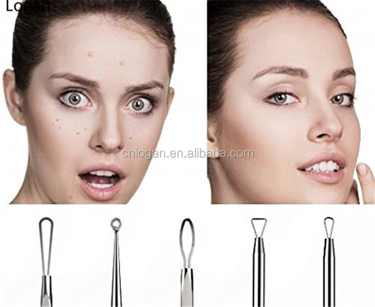 Multi-Function Beauty Tool Comedone Extractors Kit for Removing Blackhead Skin Care Extractors Blemish Extractors