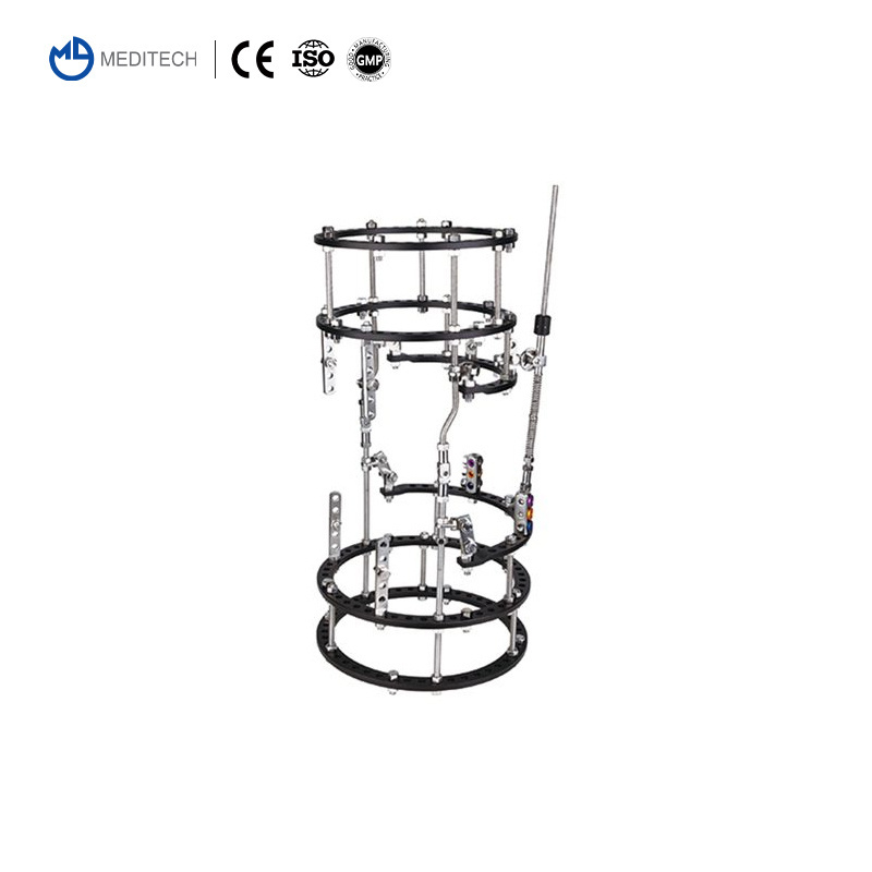 Orthopedic Instruments Ilizarov Talipes Equinovalgus  Bone Lengthening External Fixator Ilizarov Ring Fixator