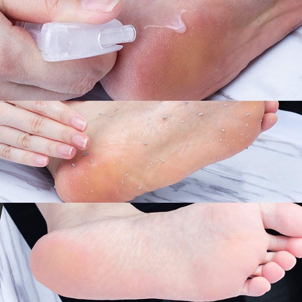 Remove Dead Skin Private Label Foot Moisturizing Hydrating Nourish Peel Orange Oil Foot Peeling Spray