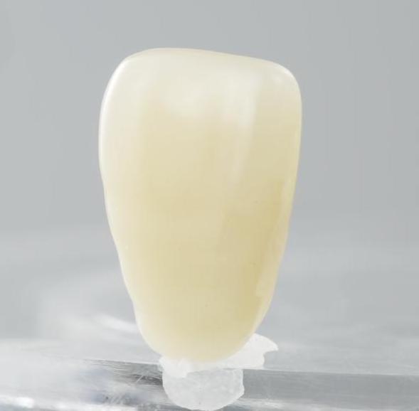 Two-Layer Acrylic Resin Teeth ANTERIOR: 6*16 dental consumables implants ALUMINA GLASS