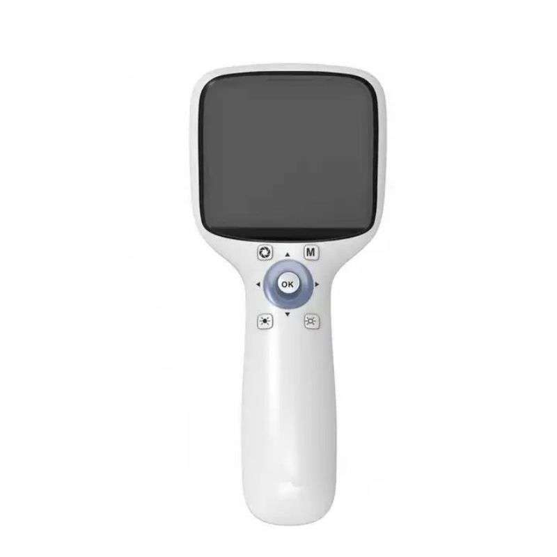 Portable Non-Mydriatic Fundus Camera NES-1000p Ophthalmic Handheld Eye Retinal Instrument from China