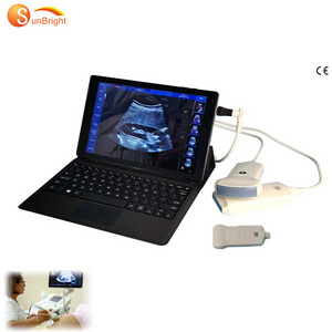 Android USB linear high frequency ultrasound probe medical probe price for MSK