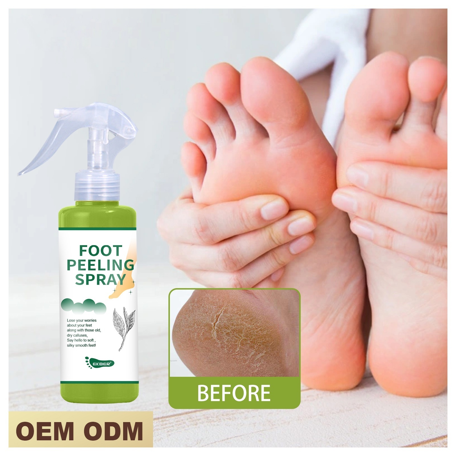 Customize Logo Make Your Feet Baby Soft Green Tea Orange Foot Exfoliate Peel Off Spray Cracked Heels Dead Skin Calluses