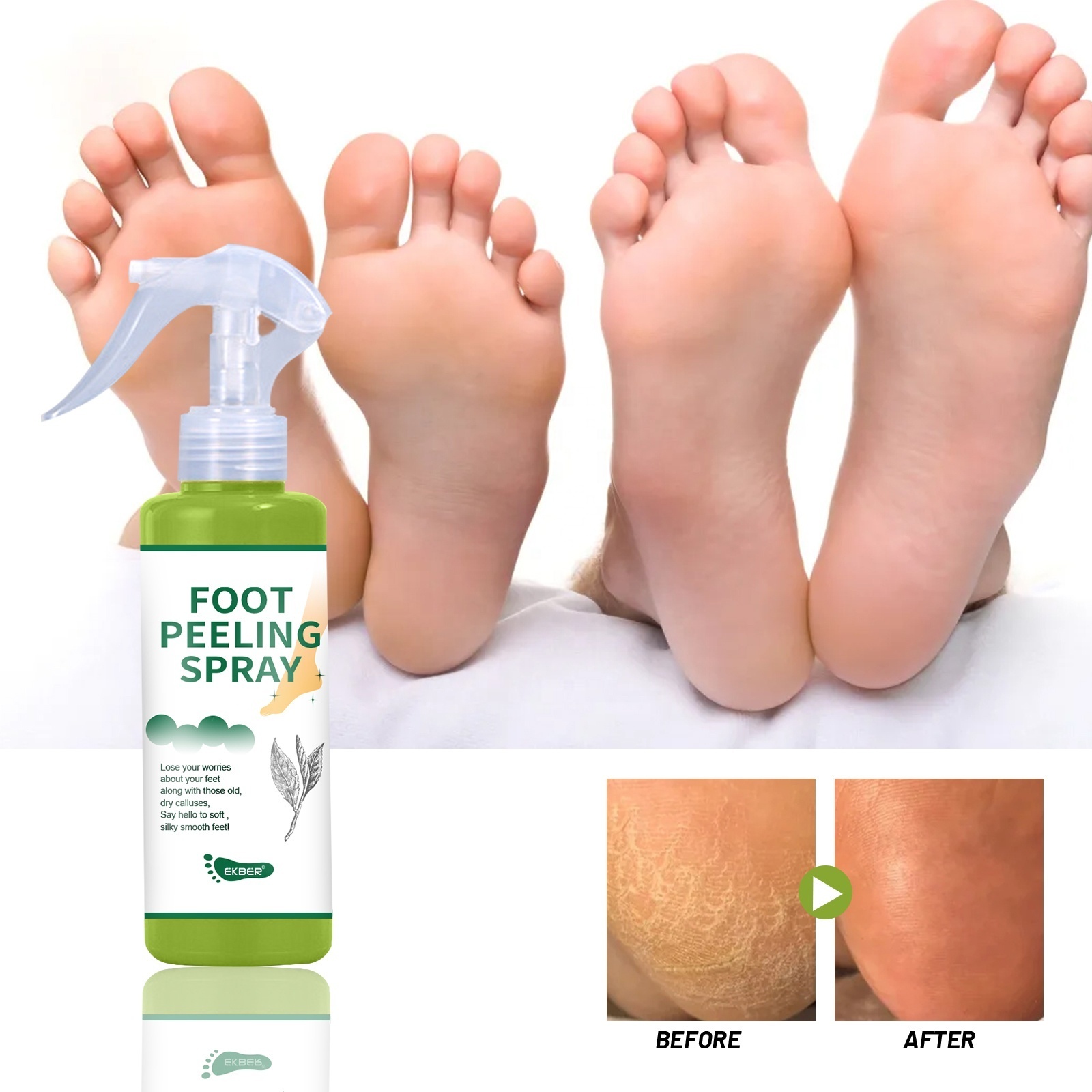 Private Label Dead Skin Removal Foot Exfoliate Peel Off Spray Callus Moisturizes Soften Feet Balm For Dry Cracked Heels