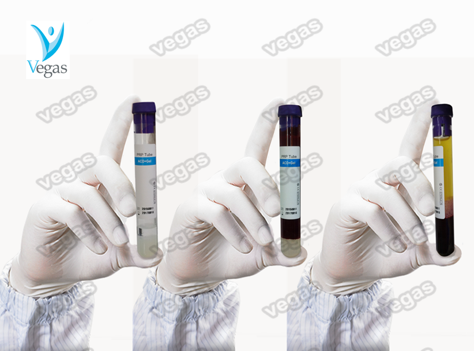 High concentration of platelets 10ml and 15ml prp tube and PRP kit