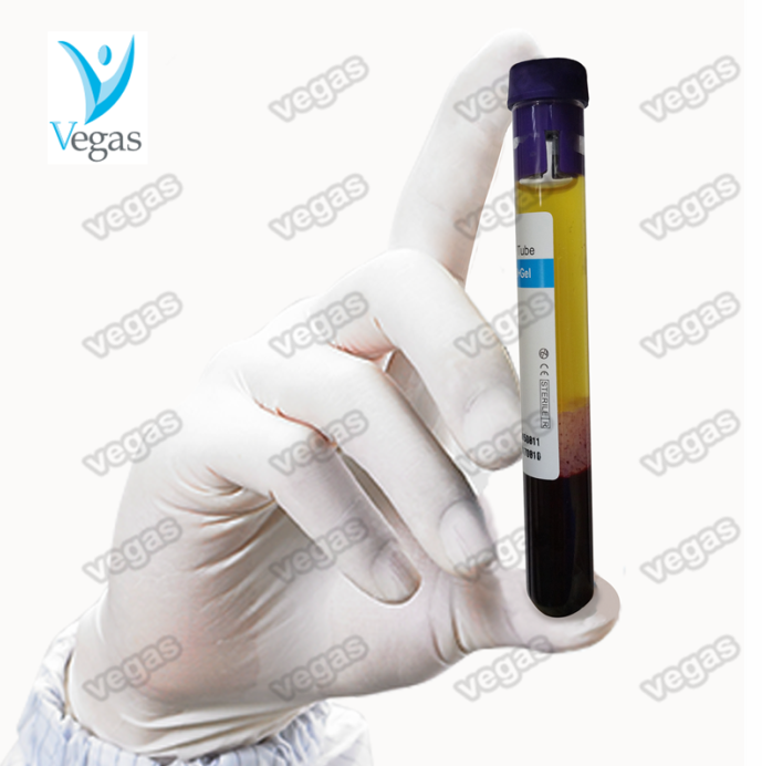 CGF cell regeneration platelet rich plasma PRP kit and PRP tube