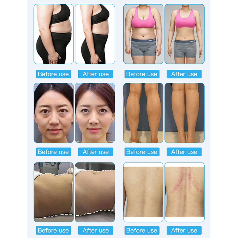 2023 Hot Sale 9 In 1 Multifunction Beauty Machine/lipolaser/cavitation/ Vacuum/rf Slimming Lipo Laser Cavitation Machine