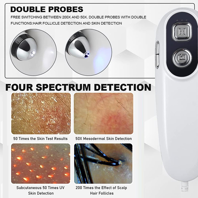 Hot Products Hd Hair Follicles Scalp Scanner Detector Hair Analyzer / Skin And Scalp Hair Analysis Machine