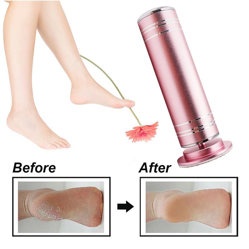 Ready Stock Pedicure Tools Electric  Foot Grinder  Feet Dead Skin Callus Remover Electric Foot Callus Remover