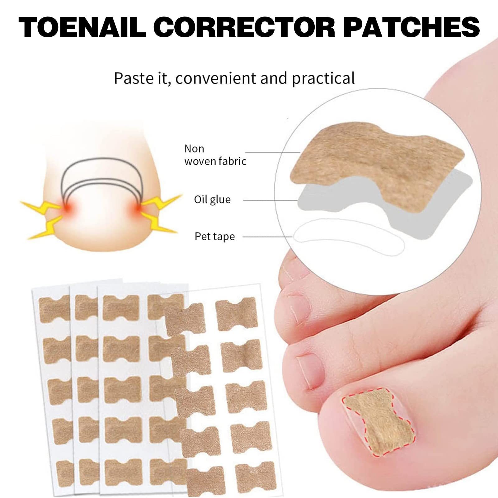 Ingrown Toenail Treatment Ingrown Toenail Removal Kit with Pedicure Toenail Corrector Patch