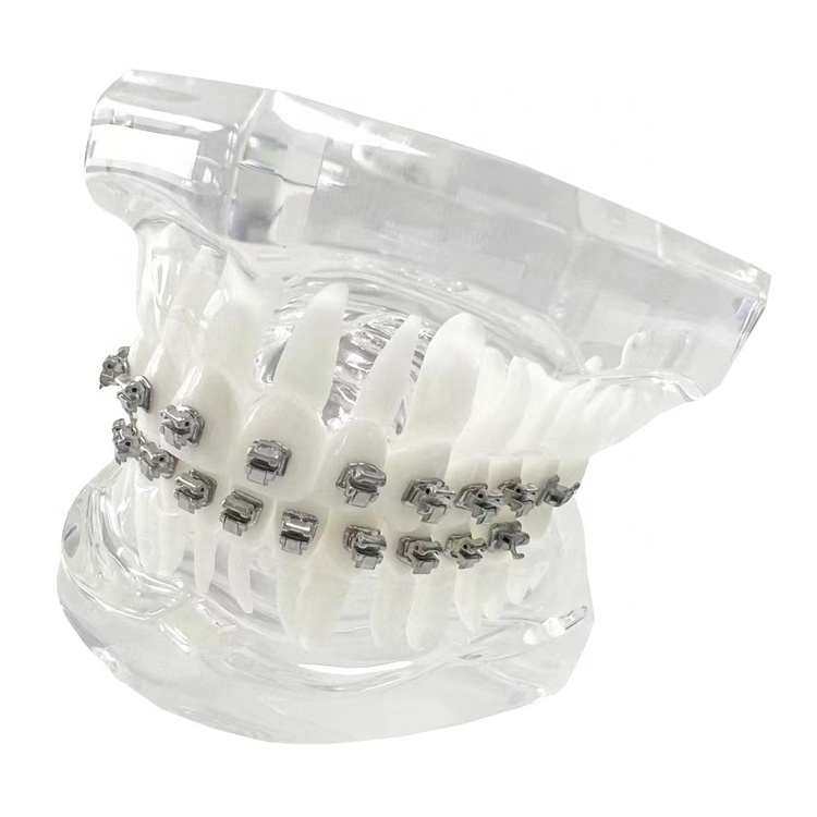 Tiantian dental beauty equipments braces orthodontics brackets self ligating brackets braces for teeth