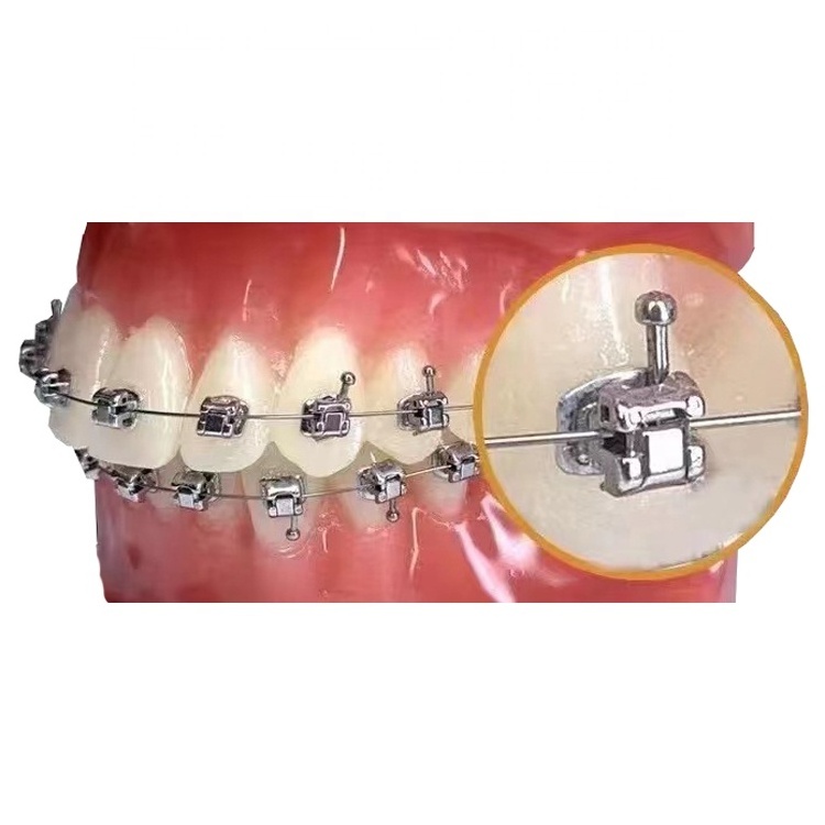 Tiantian dental beauty equipments braces orthodontics brackets self ligating brackets braces for teeth