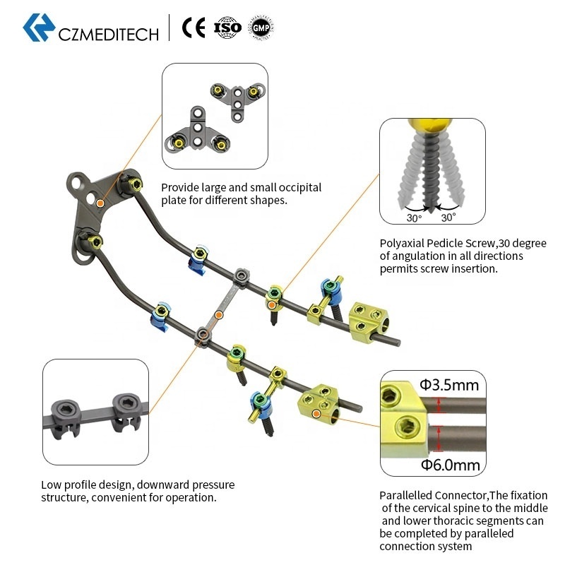 High quality Spine Titanium Fixation System Orthopedic Implants Spinal Posterior Cervical Screw System polyaxial screws