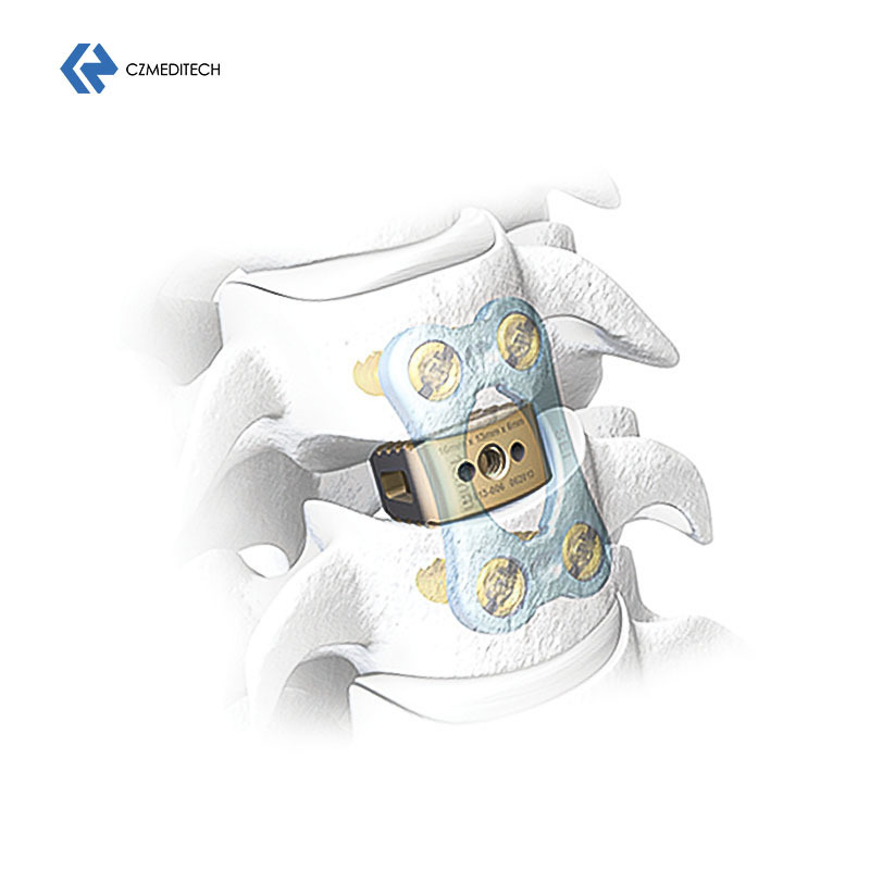 2024 New Design Customized CE/ISO Quality Guaranteed Cervical Peek Cage