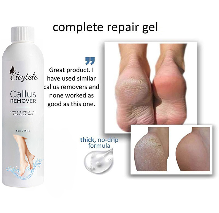 Professional Foot Care Tea Tree Oil Peeling Exfoliating File Callus Remover Cracked Heel Callus Remover Foot Exfoliating Gel