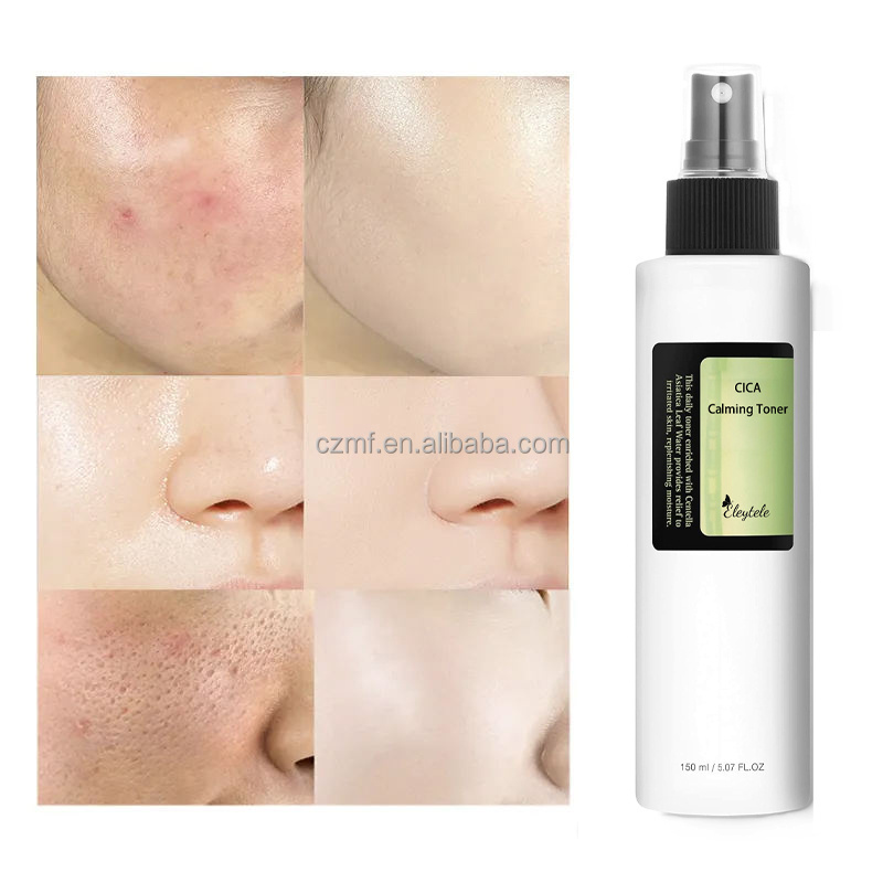 Customized Logo Face Skin Care Niacinamide Hydrating Whitening Dark Spots Removal Anti Acne Toner Facial Cica Toner For All Skin