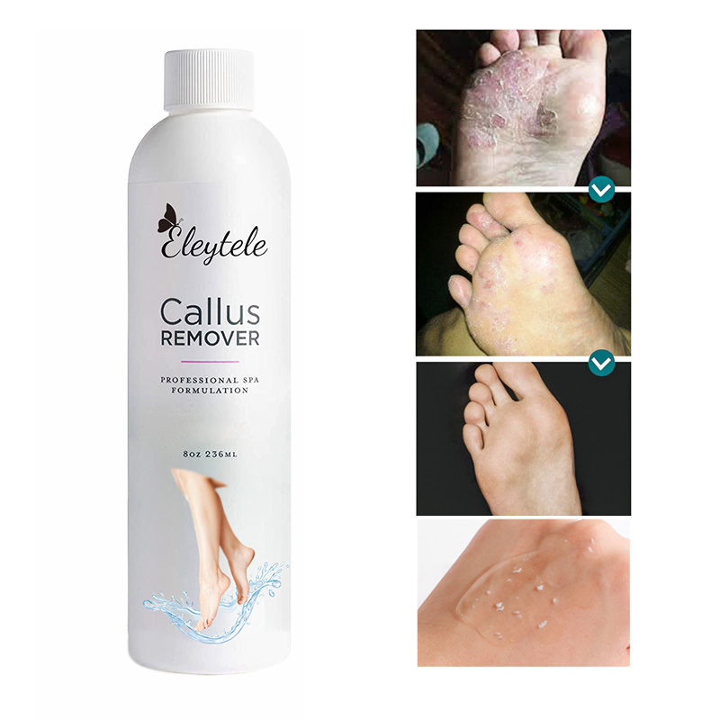 Professional Foot Care Tea Tree Oil Peeling Exfoliating File Callus Remover Cracked Heel Callus Remover Foot Exfoliating Gel